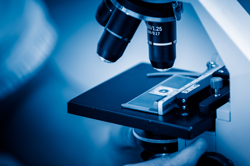Mikroskopische Untersuchung zur Diagnose von Scheidenkrebs