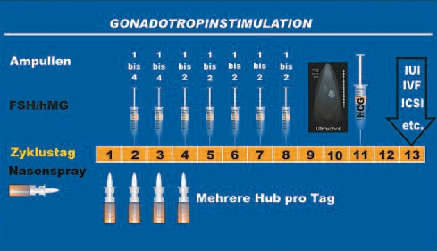 Stimulationsbehandlung mit Gonadotropine